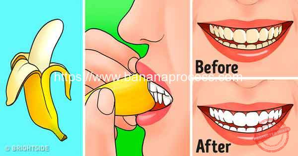 Banana-Peel-Whiten-Teeth